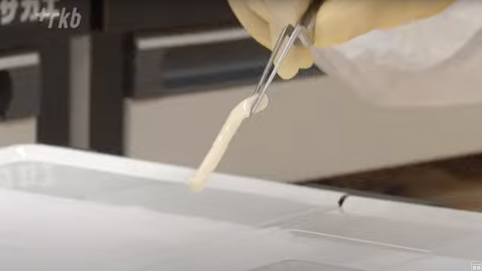 “再生医療”３Ｄプリンターで細胞から血管や神経を作製…移植患者の知覚神経が回復
