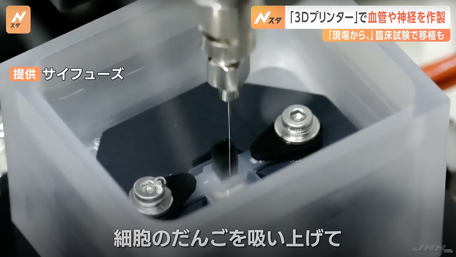3Dプリンターで「血管」「神経」を作製！？臨床試験で移植も実施…“夢の治療法”に迫る｜TBS NEWS DIG