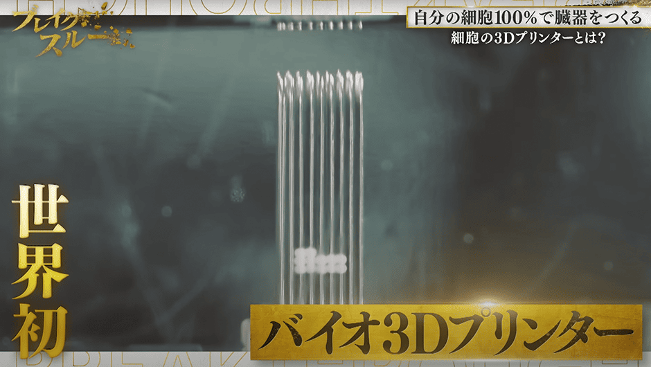 ブレイクスルー【未公開版】／再生医療をビジネスの実現へ！“固執しない経営”が成功を引き寄せる！